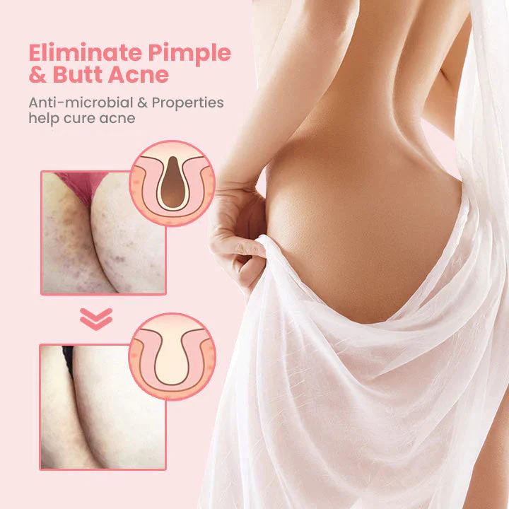 Oveallgo™ BootyBoost AntiAcne Exfoliating Natural Soap - Image 2
