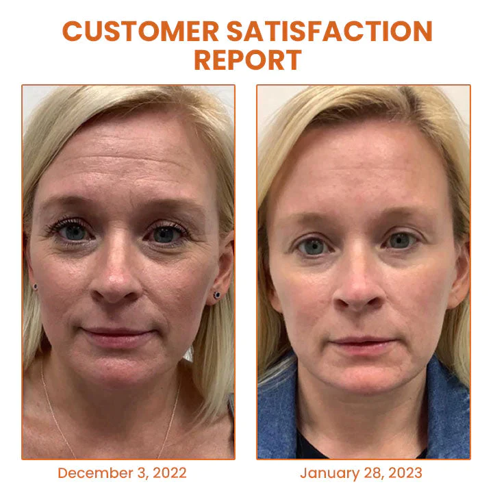 Oveallgo™ Byeol Korea Infusing Collagen Anti-aging Mask - Image 3