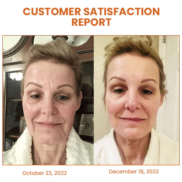 Oveallgo™ Byeol Korea Infusing Collagen Anti-aging Mask - Image 4