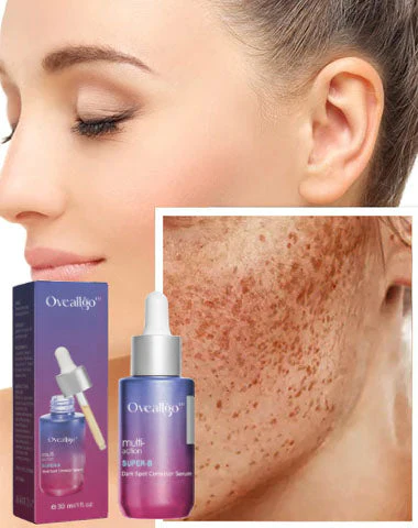 Oveallgo™ Super-B Dark Spot Corrector Serum - Image 4