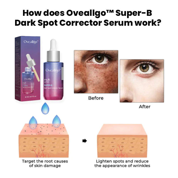 Oveallgo™ Super-B Dark Spot Corrector Serum - Image 3