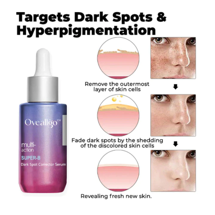 Oveallgo™ Super-B Dark Spot Corrector Serum - Image 2
