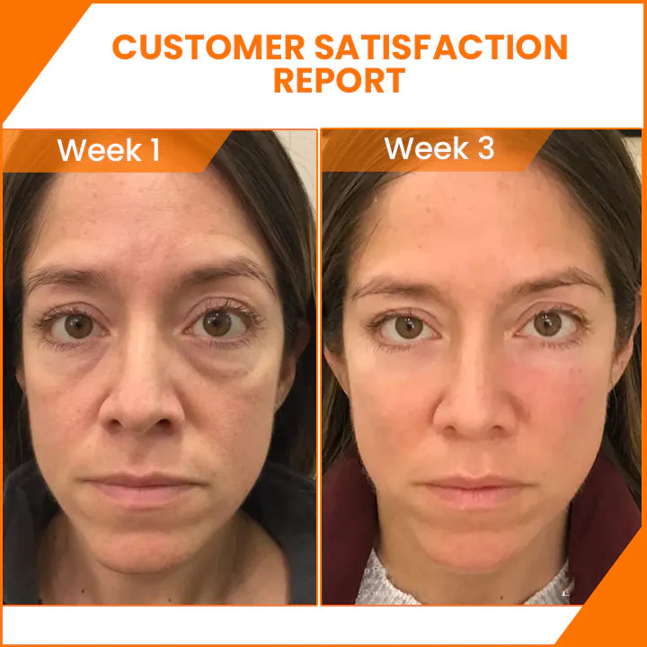 Oveallgo™ PureCare Vitamin C Brightening Eye Serum - Image 5