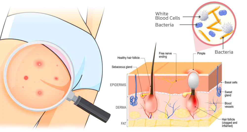 flysmus™ BootySmooth Exfoliating Natural Soap - Image 4