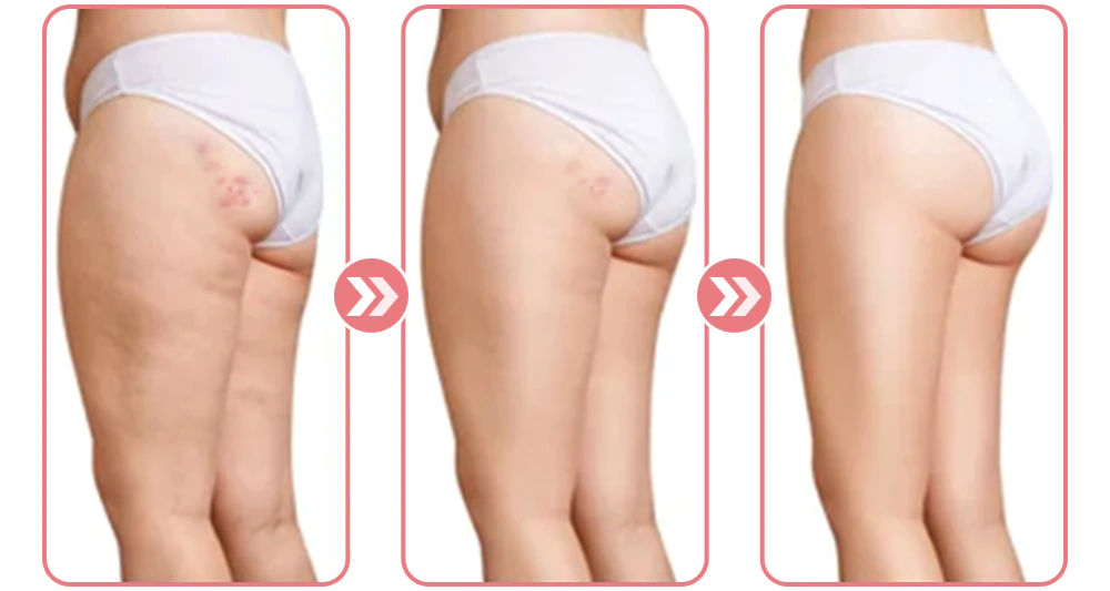 flysmus™ BootySmooth Exfoliating Natural Soap - Image 6