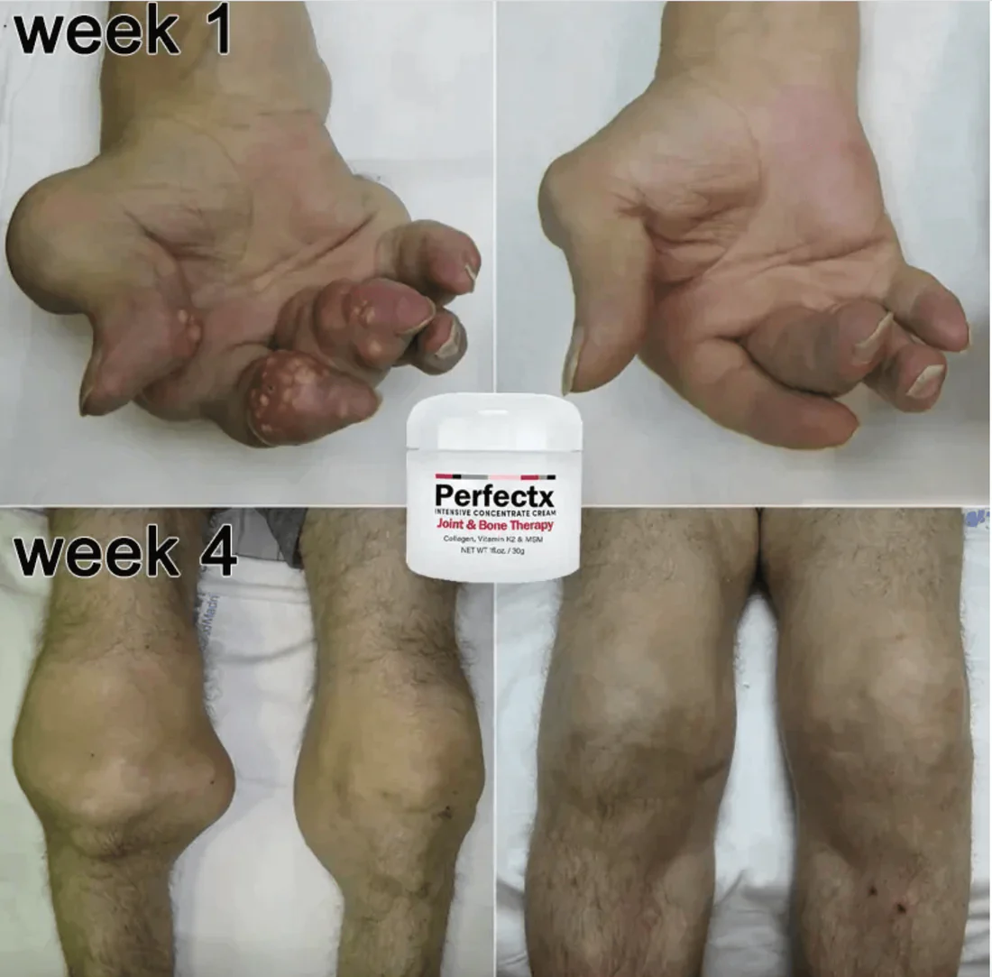 GFOUK™ Perfectx Joint And Bone Therapy Cream - Image 3