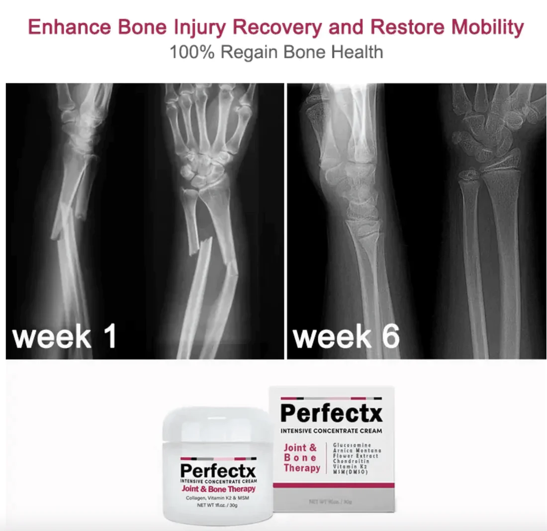 GFOUK™ Perfectx Joint And Bone Therapy Cream - Image 4