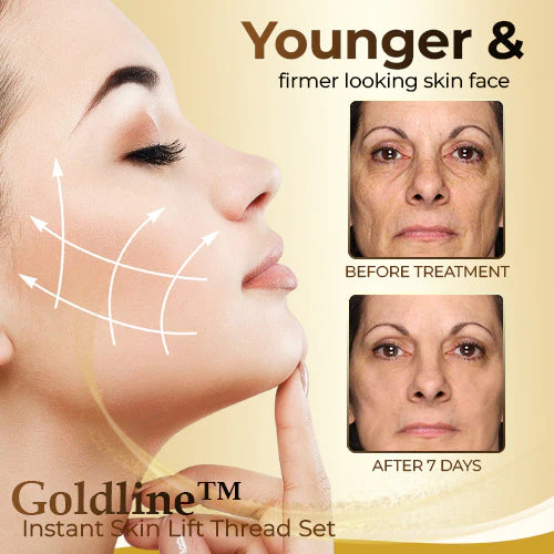 Goldline™ Instant Skin Lift Thread Set - Image 3