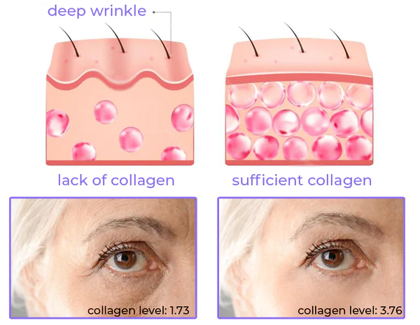 Soluble Collagen Thread & Nano Platinum Essence Facial Firming Set - Image 8