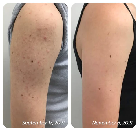 Oveallgo™ Keratosis Treat Deep Clean Smooth Creme - Image 7