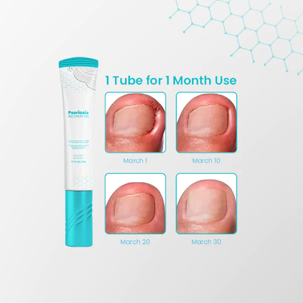 NailRevive™ Psoriasis Recovery Gel - Image 6