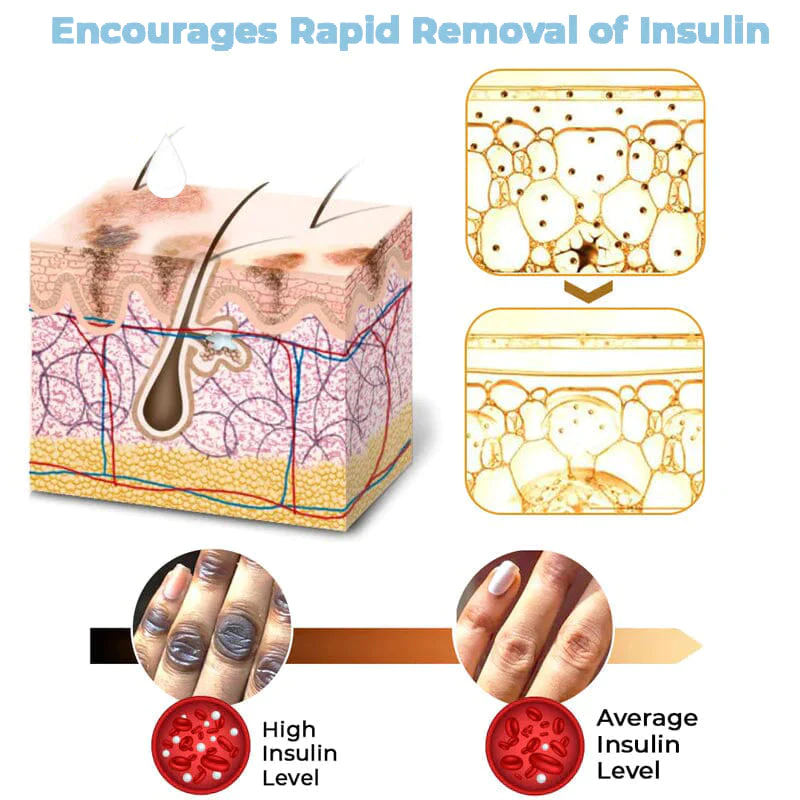 ElEMOS® Collagen Boost Acanthosis Nigricans Therapy Cream - Image 2