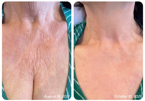 flysmus™ Premium Goat Milk Collagen Firming Neck Mask - Image 7