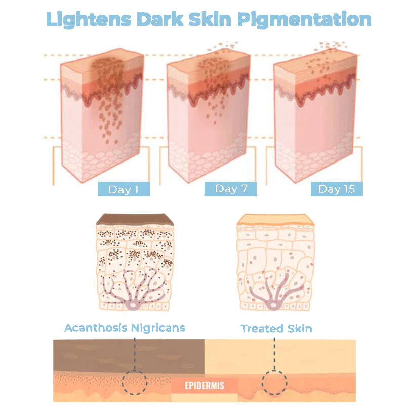 ElEMOS® Collagen Boost Acanthosis Nigricans Therapy Cream - Image 3