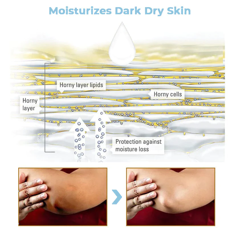 ElEMOS® Collagen Boost Acanthosis Nigricans Therapy Cream - Image 4