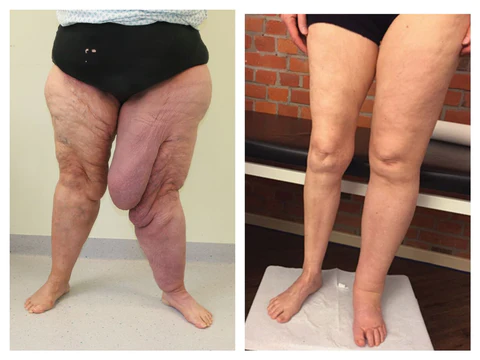 Herbal PRO Detox&Shaping Cleansing Foot Soak Beads - Image 8