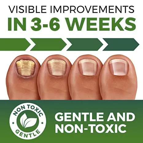 FootFree™ Antifungal - Professional Strength - Image 6