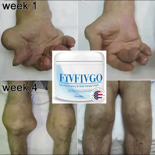 Oveallgo™ Joint & Bone Therapy Cream - Image 6