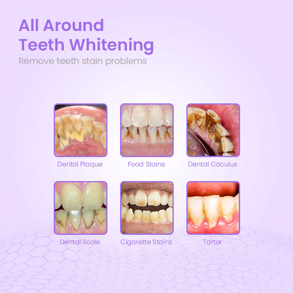 HerbalBrite™ Teeth Whitening Mousse - Image 8