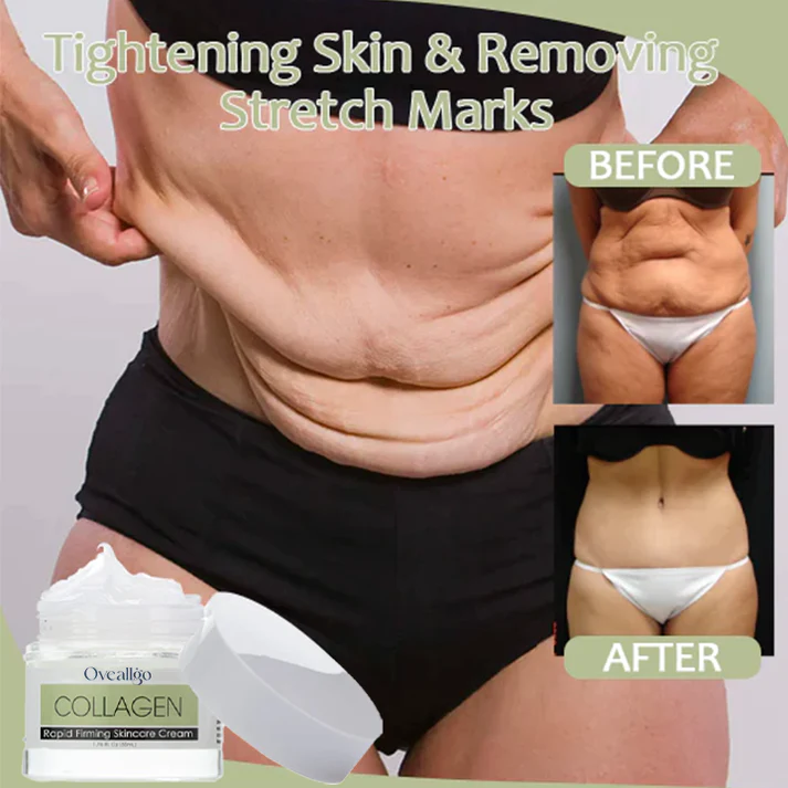 Oveallgo™ Collagen Boost Rapid Firming&Lifting Cream - Image 2