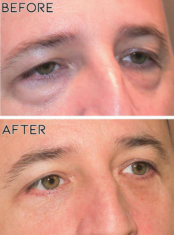 Oveallgo™ Men PLUS Expert Hydra Energetic Eye Roller - Image 6