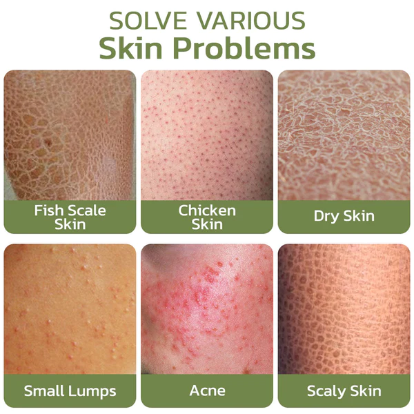 Oveallgo™ Keratosis Treat Deep Clean Smooth Creme - Image 6