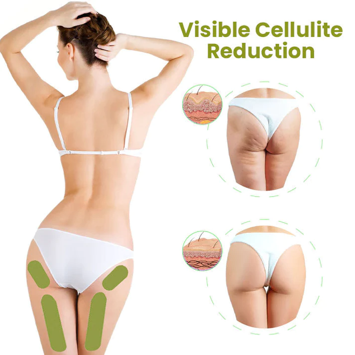 Oveallgo™ Pro HerbalFirm Cellulite Reduction Patches - Image 3