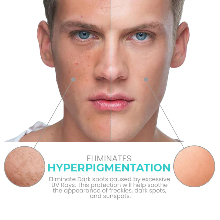 Oveallgo™ Korea TimerAge Men Oil-Control Tone-Up Cream - Image 7