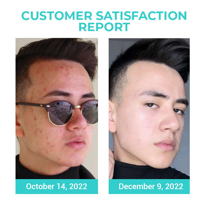 Oveallgo™ Korea TimerAge Men Oil-Control Tone-Up Cream - Image 5