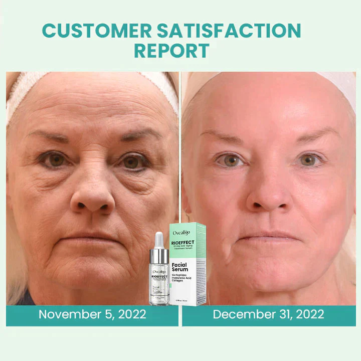 Oveallgo™ RIOEFFECT PRO 30 Day Anti-Aging Treatment Serum - Image 11