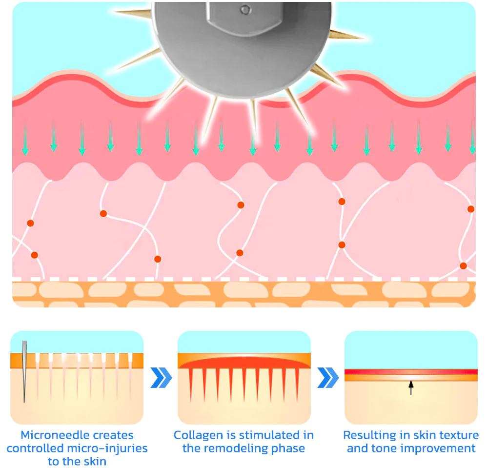 flysmus™ BoLiftox PockmarksTreat Collagen Astaxanthin Roller - Image 5