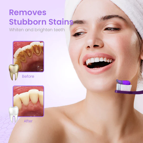 HerbalBrite™ Teeth Whitening Mousse - Image 5