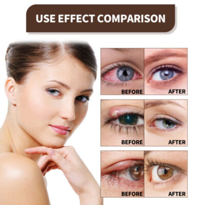 EYELIGHT™ Ultra Eye Therapy Drops