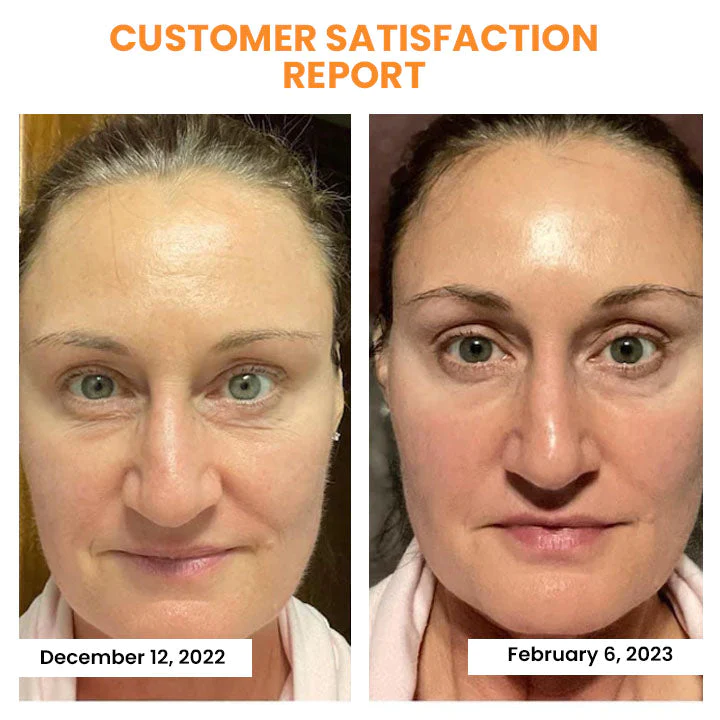 Oveallgo™ Korean Dermalayr Technology Soluble Collagen Film - Image 5