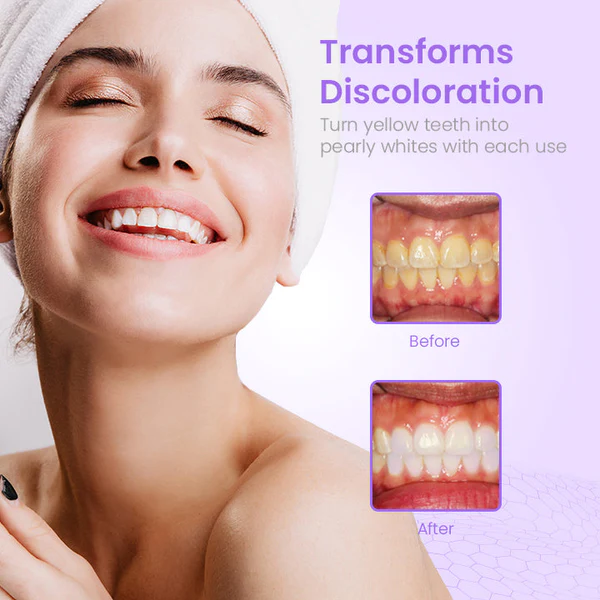 HerbalBrite™ Teeth Whitening Mousse - Image 6