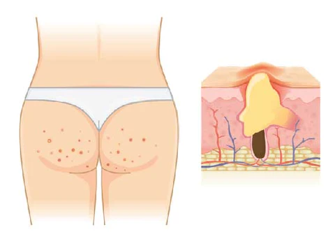 Fivfivgo™ ButtSize Plumpy Up Smoothing Cream - Image 4