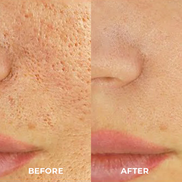 Skinetic™ Single-Packaged Eggplants Mud Mask - Image 7