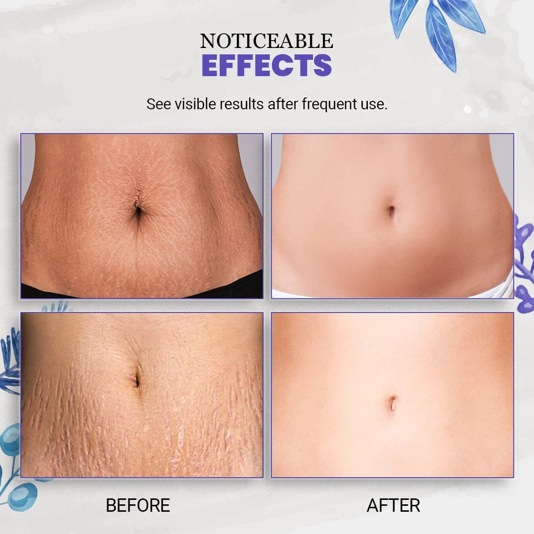 EarthBlend™ Stretch Mark Vanisher - Image 5