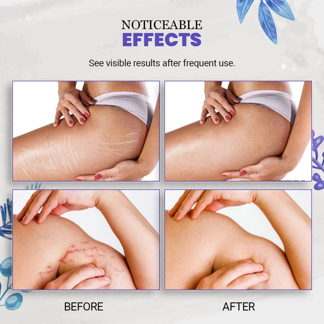 EarthBlend™ Stretch Mark Vanisher - Image 4