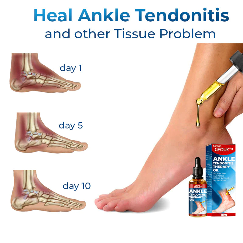 GFOUK™ German Ankle Tendonitis Therapy Oil - Image 4