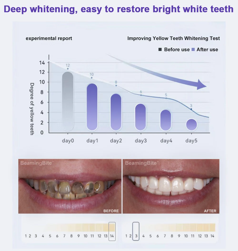 BeamingBite™ Whitening Mouthwash - Image 5