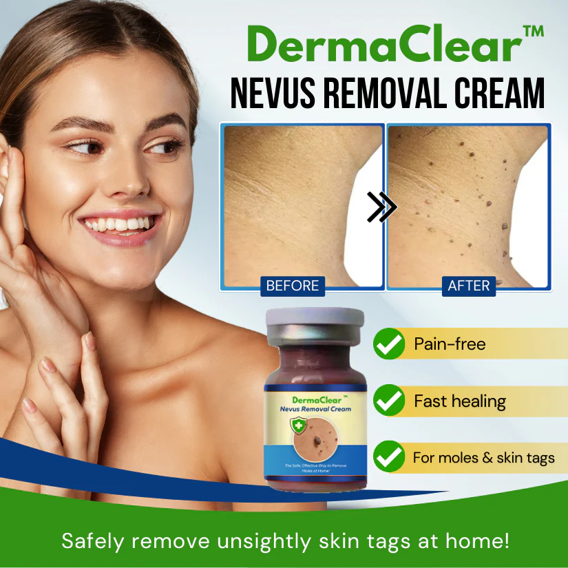 DermaClear™ Nevus Removal Cream - Image 2