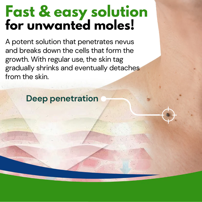 DermaClear™ Nevus Removal Cream - Image 3