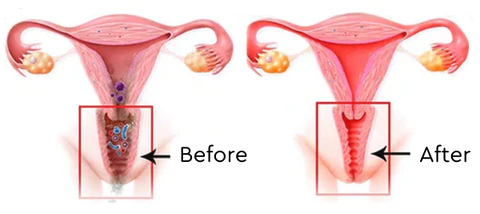 LeanLady™ Detox & Slimming Capsule - Image 7