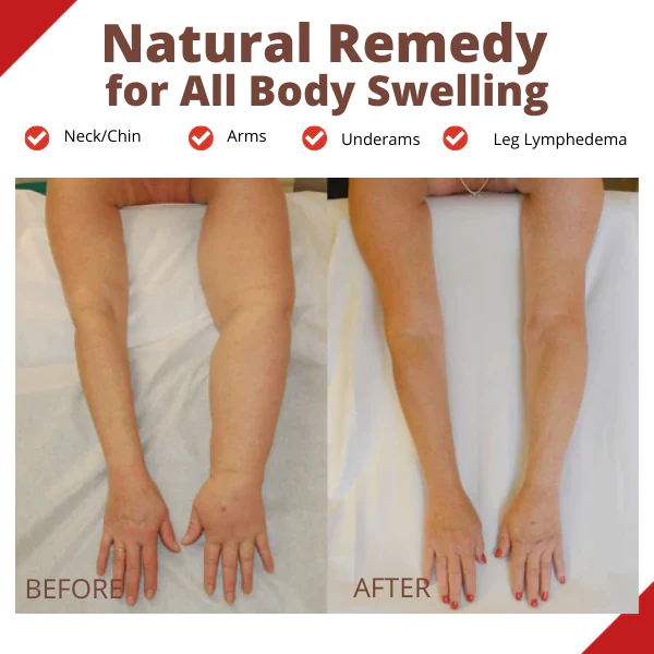 HeaLymph™ Treatment Patch - Image 5