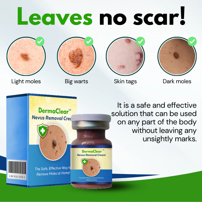 DermaClear™ Nevus Removal Cream - Image 4