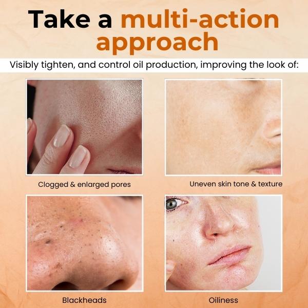 DermaZen™ Pore Minimizer Facial Mask - Image 2