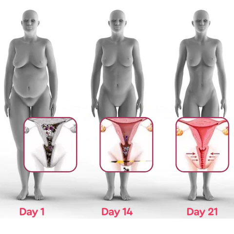 LeanLady™ Detox & Slimming Capsule - Image 9