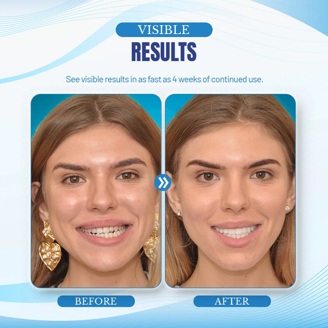 NightBite™ Jaw Alignment Brace - Image 7