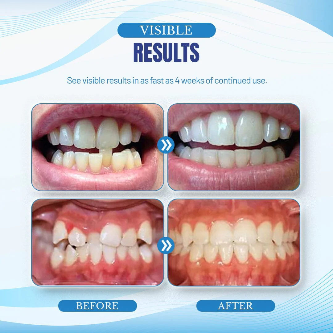 NightBite™ Jaw Alignment Brace - Image 8